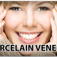 porcelainveneers