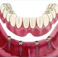 newteethdental