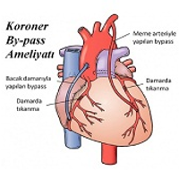 bypassameliyati