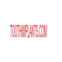 toothimplants
