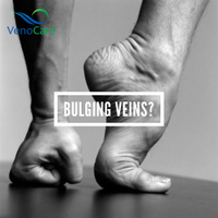 VenoCare