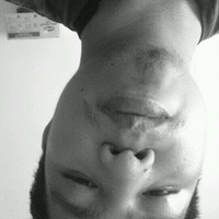 remz